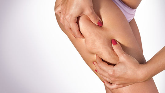 Cellulite Behandlung